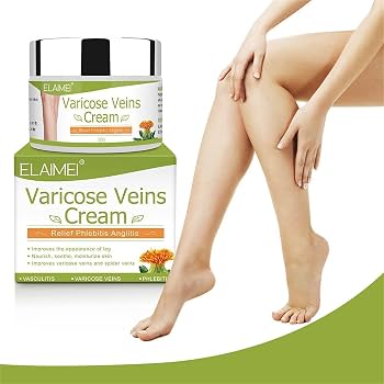 Crema para aliviar las venas varices